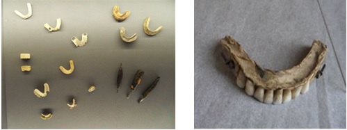 Ivory denture examples