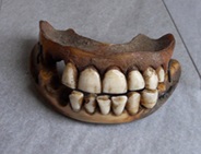 Example of dentures made from Waterloo teeth
